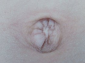 300人のへそ 2　サンプル画像05